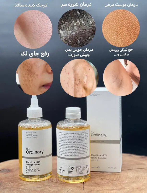 تونر گلایکولیک اسید 7% اوردینری